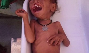 श्योपुर: एक के बाद एक कुपोषित बच्चे जिंदगी और मौत से जूझते रहते हैं, लेकिन महिला बाल विकास विभाग के कान में जू तक नही रेंगती..