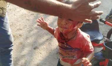 काफी दिनों से खुले पड़े नाले में दो बच्चे खेलते समय गिरे, कई बार शिकायत पर भी नगर निगम ने नही ढका