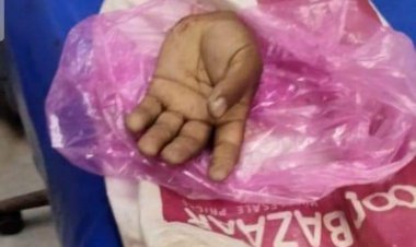 दलित, युवक ने अपनी मजदूरी मांगी तो  आरोपी गणेश मिश्रा, ने मजदूरी के जगह दलित का तलवार से काट दिया हाथ